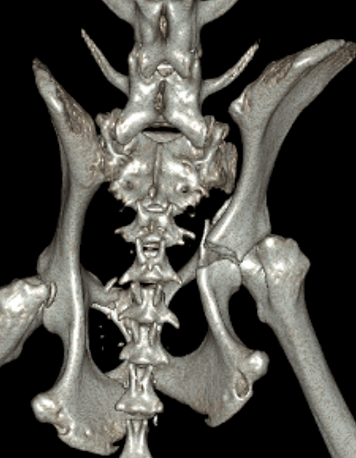 Radiograph showing a limb fracture