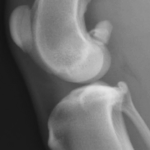 Normal joint alignment of the stifle