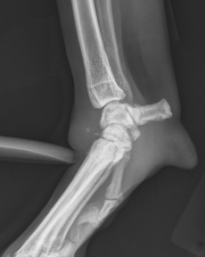 Stress radiograph demonstrating carpal hyperextension injury