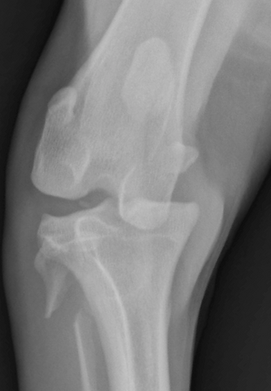 Stress radiography demonstrating a ligament injury.