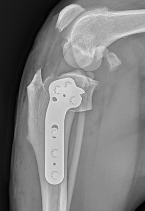 TPLO leveling illustration and post-operative radiograph.