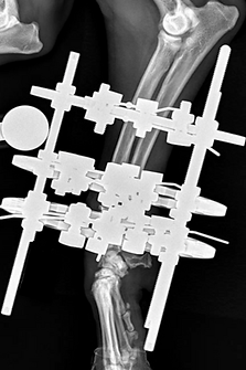 External fixator on an antebrachial fracture