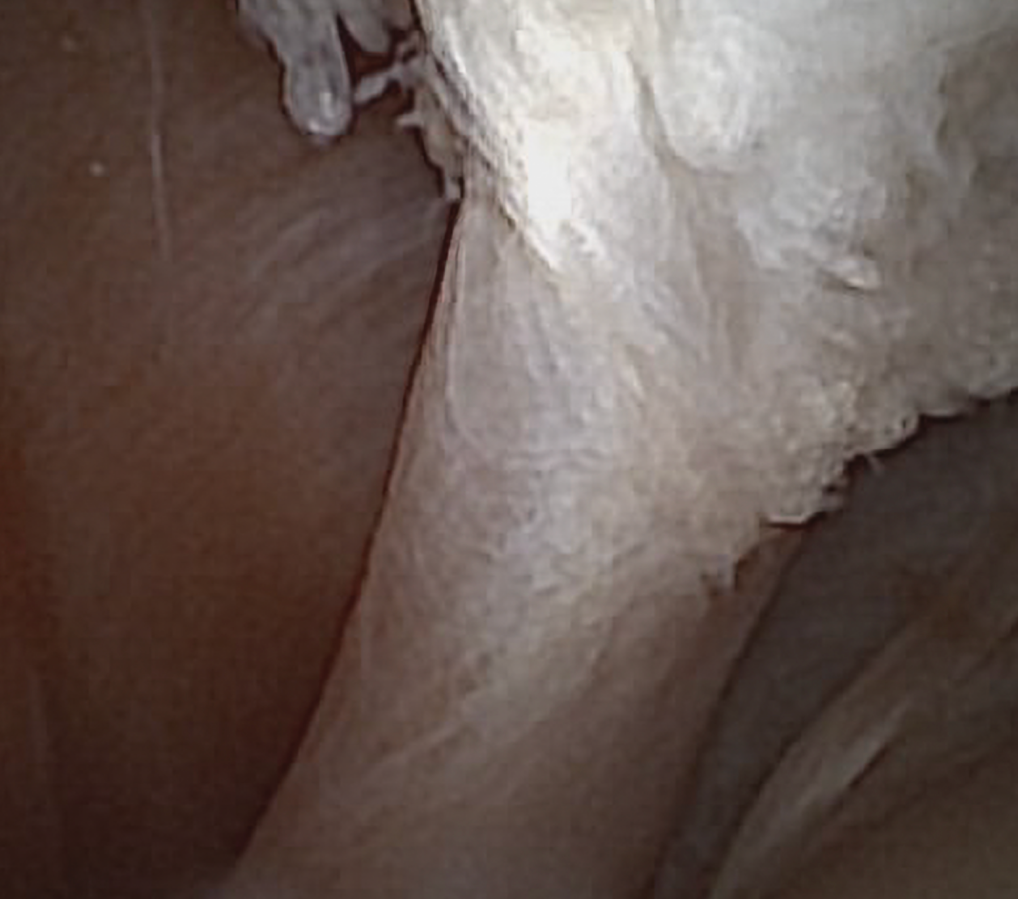 Needle arthroscopy view of the canine biceps tendon